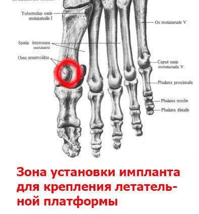 https://getfile.dokpub.com/yandex/get/https://yadi.sk/i/3f4BnbVT57rVYA